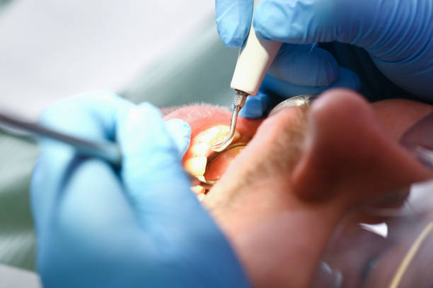 Urgent Tooth Repair in KY