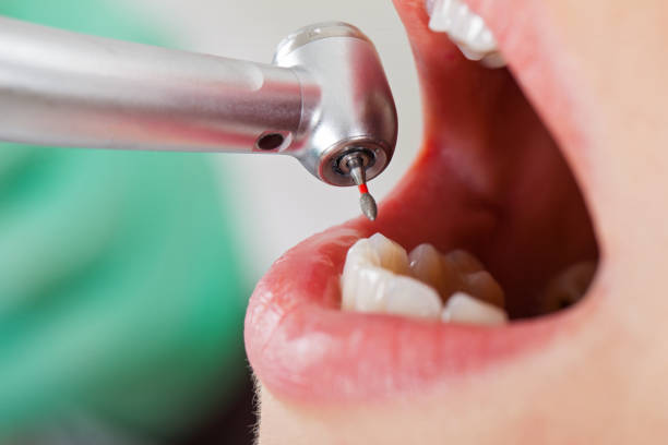 Best Cracked Tooth Emergency Dentist  in Coal Run Village, KY